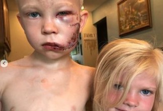Super-heróis elogiam menino de 6 anos que salvou irmã de ataque de cachorro