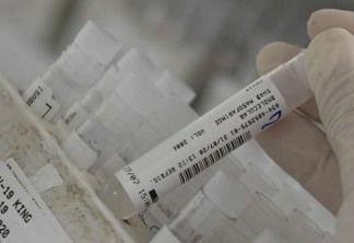 Saúde tem 9,8 milhões de testes parados por falta de insumos
