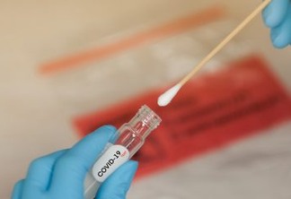 Infectologista explica as vantagens e o momento certo para realizar cada tipo dos testes de covid disponíveis