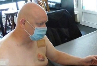 Homem é mordido no peito após briga por conta de máscara