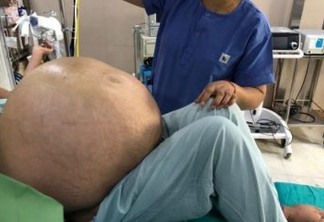 Tumor ovariano de 50 kg é removido de mulher em cirurgia; veja