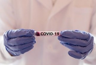 BOA NOTÍCIA: Brasil mantém tendência de queda de óbitos pelo novo coronavírus