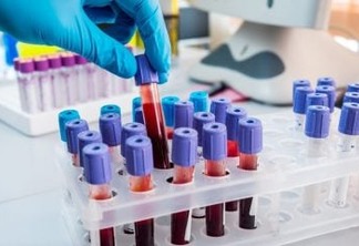Paciente é declarado curado do HIV após receber um transplante de células-tronco