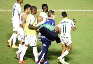 Felipe Melo tem fratura no tornozelo e desfalca o Palmeiras por até 4 meses