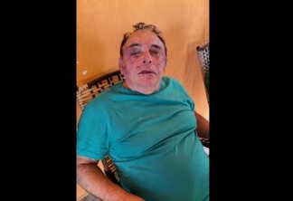 IMAGEM FORTE: Candidato a prefeito na Paraíba é brutalmente agredido durante assalto; família é feita refém
