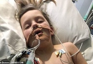 Reação à covid leva menina de 6 anos a ficar em coma: "Acreditava ser catapora", diz mãe