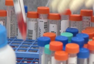 Anvisa esclarece que testes para Covid-19 não atestam proteção vacinal contra doença - LEIA NOTA