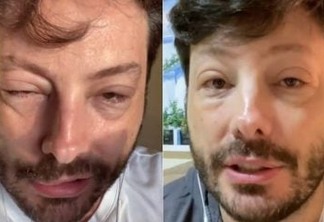 Danilo Gentili surge desfigurado e adianta: "Quase fui pro saco" - VEJA VÍDEO