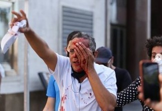 VIOLÊNCIA! Tiro de bala de borracha da PM em protesto deixa homem cego no Recife, vítima estava trabalhando 