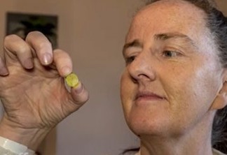 Mulher faz teste de COVID e descobre brinquedo preso no nariz há 37 anos