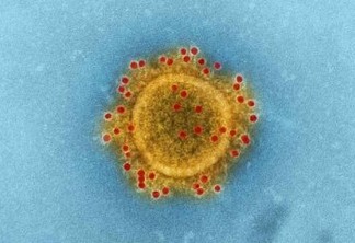 EPSTEIN-BARR: Covid longa pode estar ligada à reativação de outro vírus, diz estudo