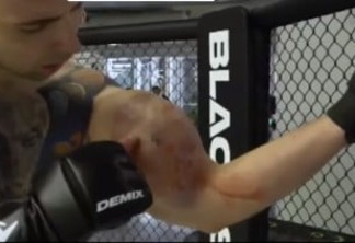 Bíceps de lutador 'explode' durante luta de MMA - VEJA VÍDEO