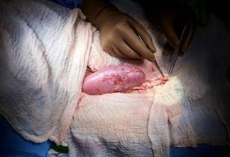 FEITO INÉDITO: Cirurgiões testam com sucesso transplante de rim de porco em humano