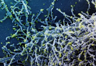 Novo Coronavírus SARS-CoV-2
Micrografia eletrônica de varredura colorida de uma célula infectada com uma cepa variante de partículas do vírus SARS-CoV-2 , isolada de uma amostra de paciente. Imagem capturada no Centro de Pesquisa Integrada (IRF) do NIAID em Fort Detrick, Maryland. Crédito: NIAID