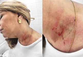 CONFUSÃO NA CÂMARA: Vereadora denuncia colega, e diz ter sido agarrada pelo pescoço e agredida em banheiro - VEJA VÍDEO
