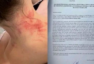 CASO AÉCIO FARIAS: Delegada pede a justiça medida protetiva contra advogado acusado de agredir a ex-esposa