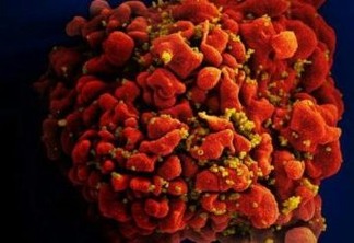 Pesquisadores descobrem variante mais contagiosa do vírus HIV