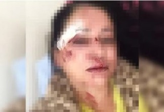 Mulher é brutalmente agredida por 9 vizinhos após denúncia de som alto