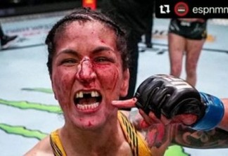 Lutadora do UFC perde dente e quebra nariz durante luta: "Me senti forte"