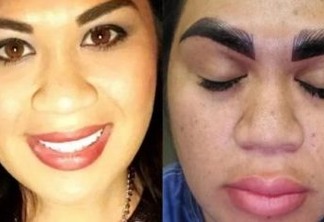 "Horripilante": Após pagar R$ 1,7 mil em preenchimento para sobrancelha, mulher se decepciona com resultado e faz vaquinha virtual para remoção
