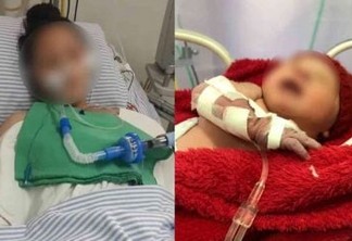 Polícia investiga caso de menina de 13 anos que deu a luz após cesárea de emergência