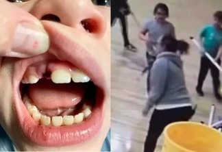 Vídeo mostra momento em que professora agride aluno com um taco de hockey, quebrando o dente dele - CONFIRA
