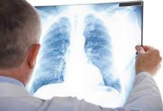 Fiocruz diz que casos de síndrome respiratória grave atingem patamar estável
