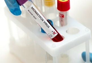 Anvisa aprova 1º teste para diagnosticar varíola dos macacos no Brasil