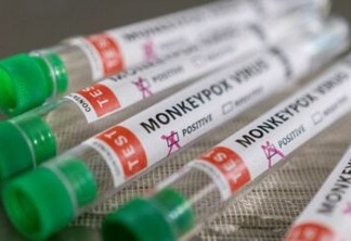 Brasil recebe o primeiro lote de vacinas contra a Varíola dos Macacos