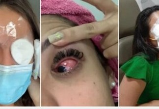 Cegueira temporária: uso de produto capilar leva mais de 200 mulheres para urgência de hospital