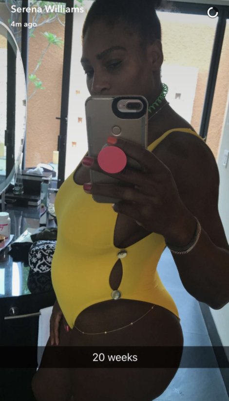 Serena Williams posta foto e levanta suspeitas de gravidez