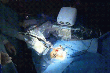 Robô “cirurgião” perfura crânios com precisão de décimos de milímetros: VEJA VÍDEO