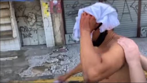 aci - Vídeo mostra que homem atingido em protesto pediu ajuda à PM e foi ignorado