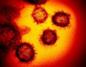 coronavirus visao microscopio 300x234 - Paraíba registra mais 3 óbitos por Covid-19 e tem ocupação de 24% dos leitos de UTI