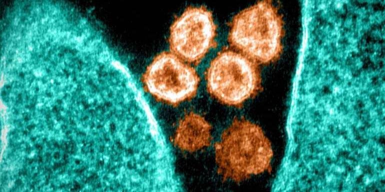jpeg - Covid, gripe e resfriado: mulher é detectada com três vírus ao mesmo tempo