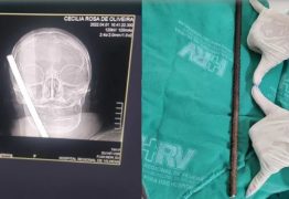 Idosa sobrevive após ter crânio perfurado por vergalhão de 30 cm