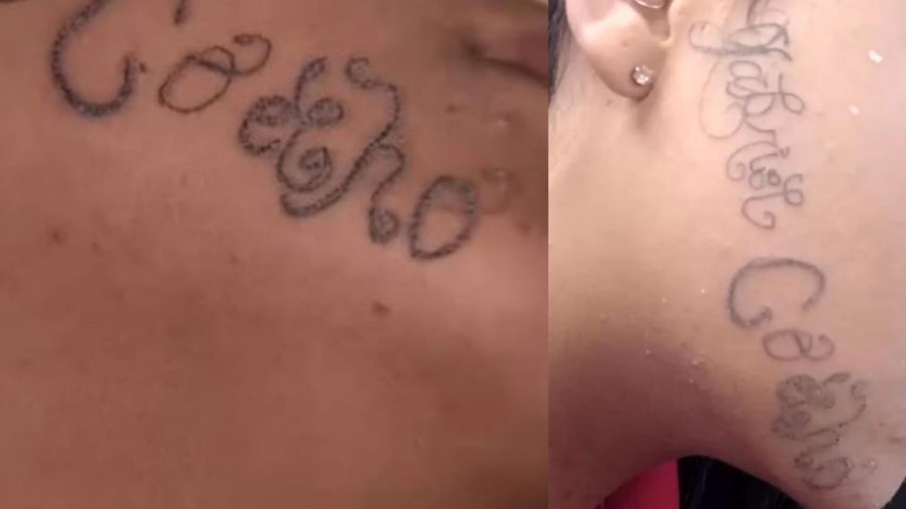 JOVEM ROSTO TATUADO - VIOLÊNCIA: Homem descumpre medida protetiva e tatua próprio nome no rosto da ex à força por não aceitar fim do relacionamento