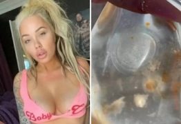 Mulher choca internautas ao retirar prótese de silicone que estava com “mofo”