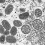 variola macacos 150x150 - Estado do Ceará confirma primeiro caso de varíola dos macacos