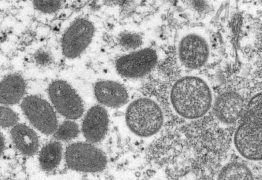 Estado do Ceará confirma primeiro caso de varíola dos macacos