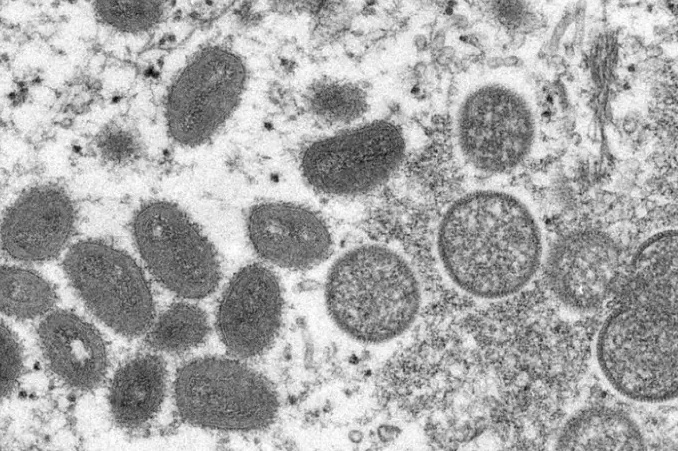 variola macacos - Ministério da Saúde confirma mais dois casos de varíola dos macacos
