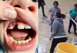 Vídeo mostra momento em que professora agride aluno com um taco de hockey, quebrando o dente dele – CONFIRA