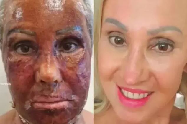 mulher - Mulher ‘troca de rosto’ após procedimento estético e mudança viraliza na web - VEJA VÍDEO