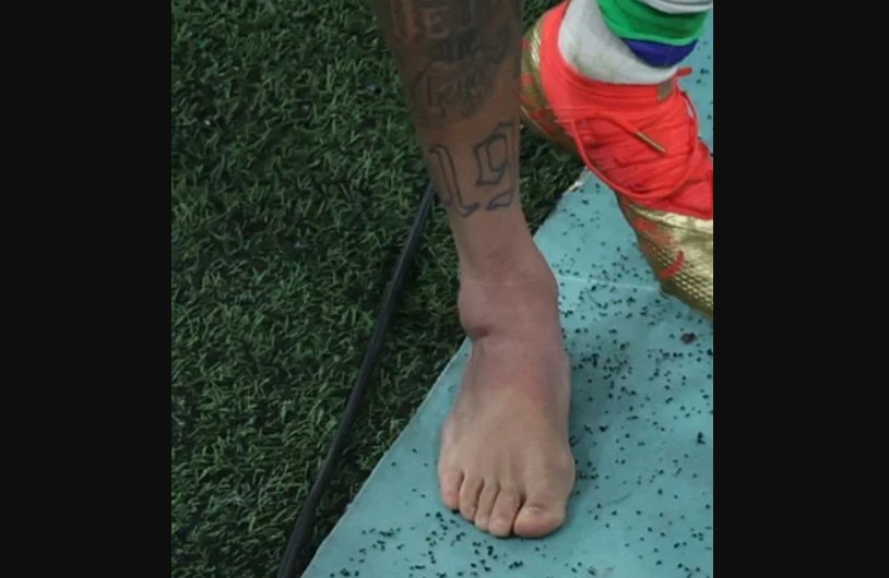 Capturar 59 - Tite tranquiliza torcida após Neymar sofrer entorce no tornozelo: 'ele vai jogar a Copa'