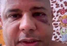 Com marcas de agressão, Marcelinho Carioca aparece em vídeo, confirma sequestro e explica motivos – ASSISTA