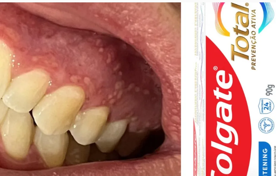 ALERTA: Anvisa volta a proibir venda de pasta de dente da Colgate ALERTA: Anvisa volta a proibir venda de pasta de dente da Colgate