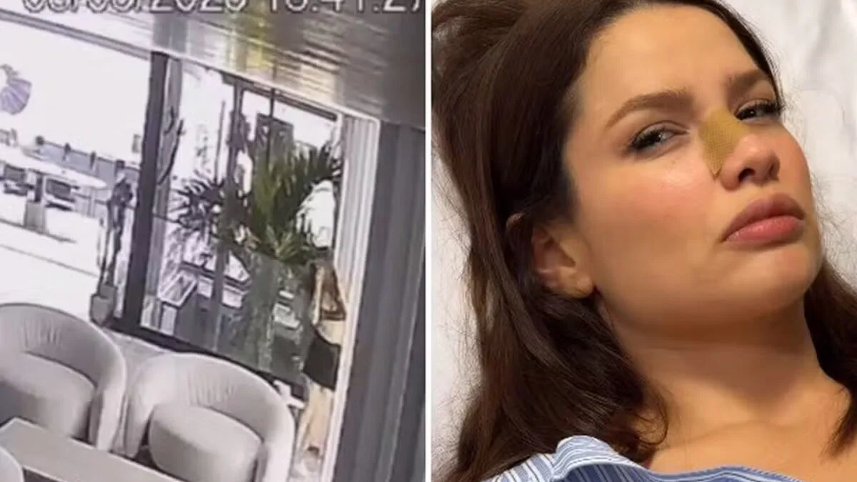 INUSITADO: Juliette fratura o nariz após bater o rosto no vidro da própria casa - VEJA O VÍDEO INUSITADO: Juliette fratura o nariz após bater o rosto no vidro da própria casa - VEJA O VÍDEO