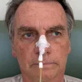 Bolsonaro anuncia alta e diz que vai ao ato pela anistia a golpistas em Brasília