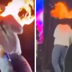 Cantor Léo fica ferido após ter rosto atingido por fogo durante show