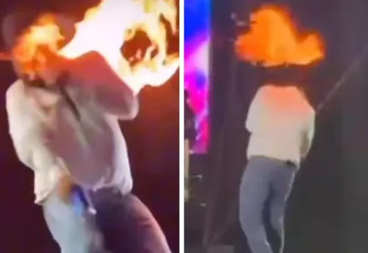 Cantor Léo fica ferido após ter rosto atingido por fogo durante show